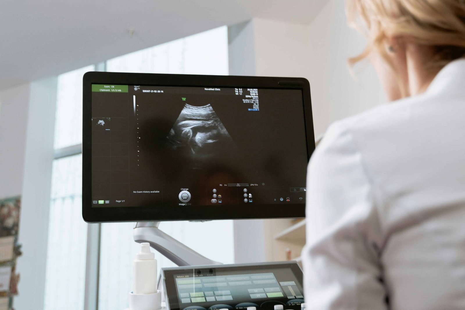 Image d’échographie à l’écran chez Bio-Test